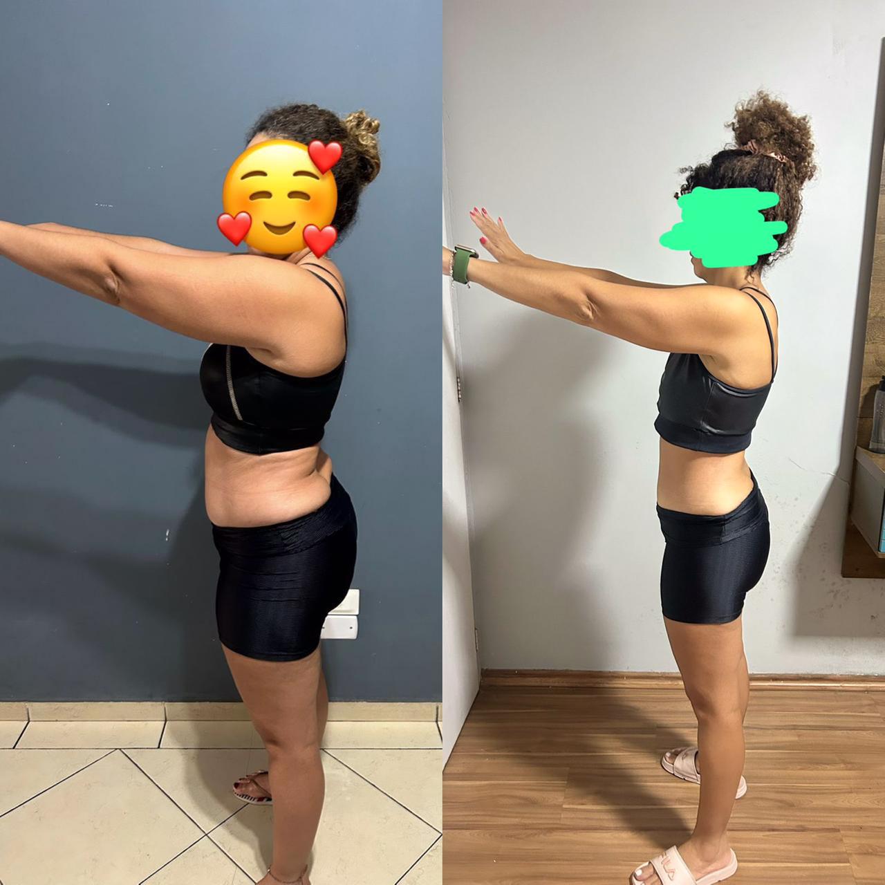 Antes e Depois 1 - R14